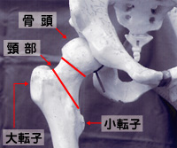 骨頭 頸部 大転子 小転子