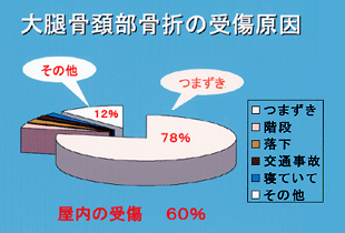 大腿骨頚部骨折の受傷原因