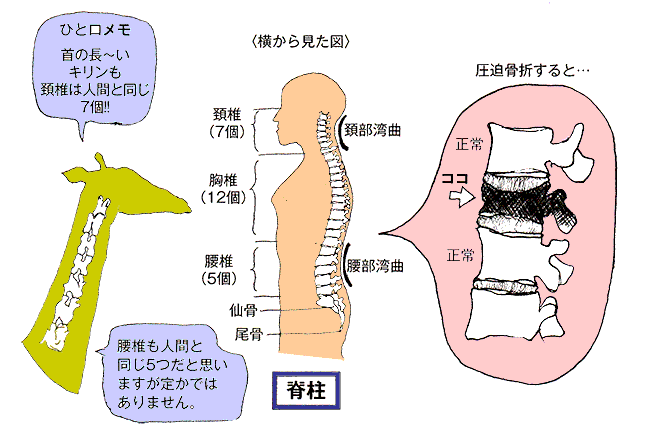 骨折 こと 圧迫 やってはいけない 【圧迫骨折 腰が痛い時に、行ってはいけない病院は？】